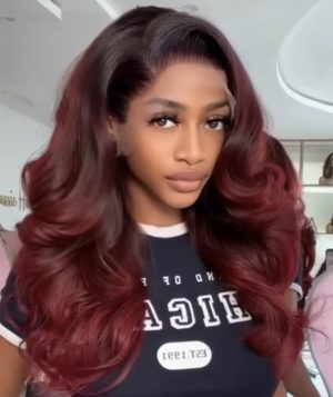 MYA